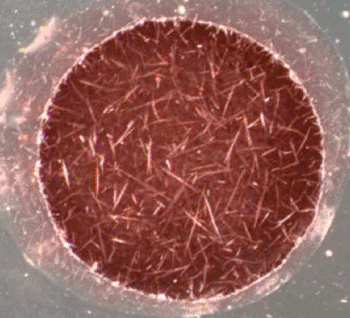 Imagen: Una microfotografía de dispersión en campo oscuro que muestra la acumulación de estructuras amiloides asociadas al diagnóstico de la enfermedad de Alzheimer (Fotografía cortesía de la Universidad de Toronto).